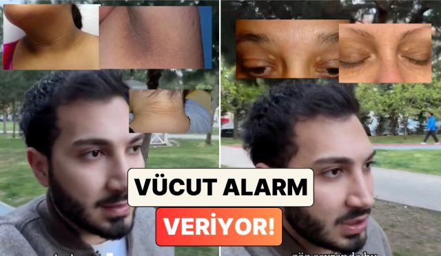 gormezden-gelmeyin-doktor-mehmet-ali-tatar-bedenimizdeki-birtakim-belirtilerin-ne-manaya-geldigini-anlatti-lFjxZSFm.jpg