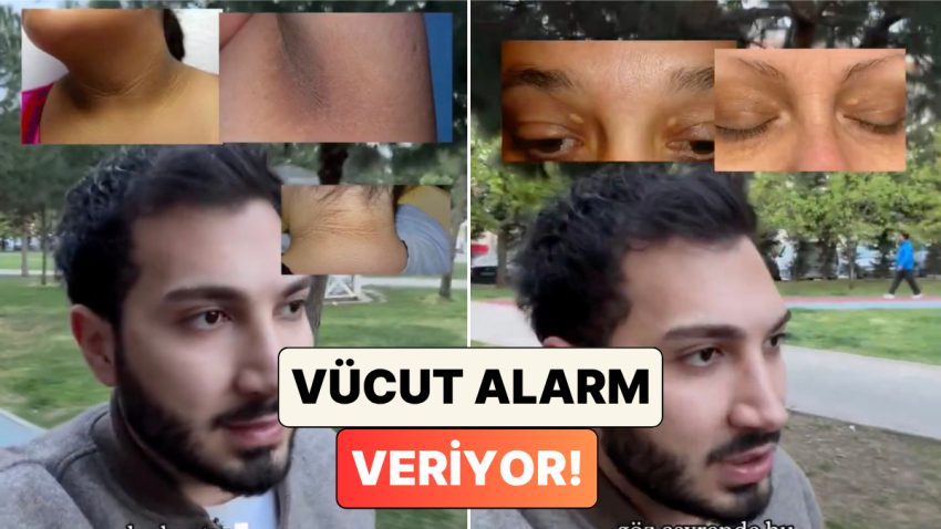 Görmezden Gelmeyin! Doktor Mehmet Ali Tatar Bedenimizdeki Birtakım Belirtilerin Ne Manaya Geldiğini Anlattı