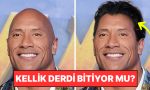 kellik-tarihe-mi-karisiyor-bilim-insanlari-sacin-tekrar-uzamasini-saglayan-serum-kesfetti-BwXJEdvV.jpg
