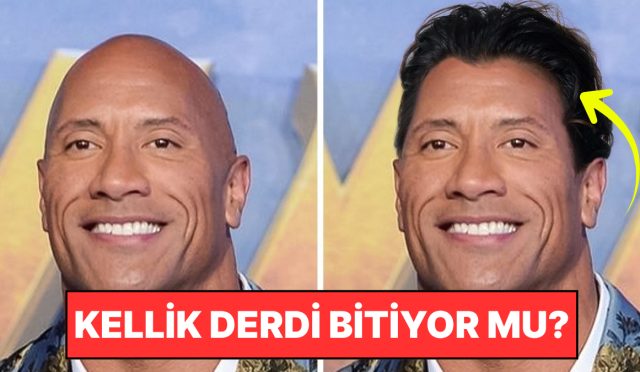 kellik-tarihe-mi-karisiyor-bilim-insanlari-sacin-tekrar-uzamasini-saglayan-serum-kesfetti-BwXJEdvV.jpg