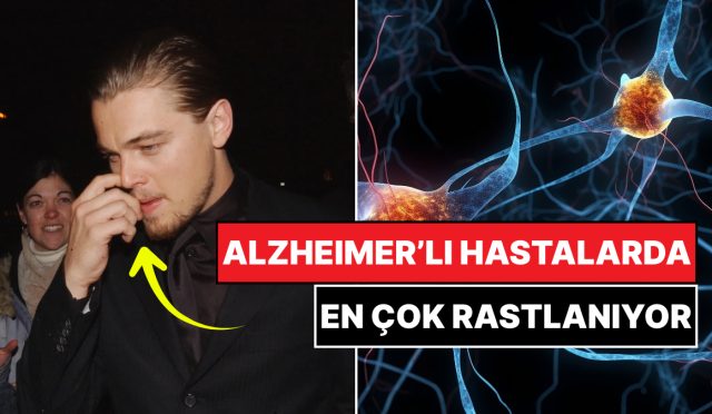 kolay-lakin-kiymetli-burun-karistirmak-ve-alzheimer-ortasinda-iliski-kesfedildi-hGDJLLqF.jpg