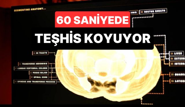 midjourneyden-sihhat-teknolojisinde-yeni-periyot-tum-bedeni-60-saniyede-tarayacak-WEO9CmiC.jpg