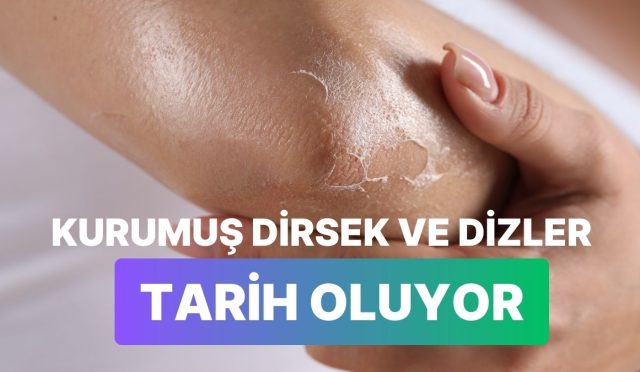 soguk-havada-kuruyan-dirsek-ve-dizlere-guzel-gelecek-bakim-eserleri-9WnVGsjF.jpg
