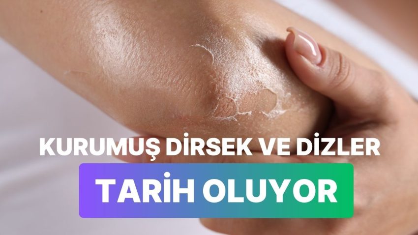 Soğuk Havada Kuruyan Dirsek ve Dizlere Güzel Gelecek Bakım Eserleri