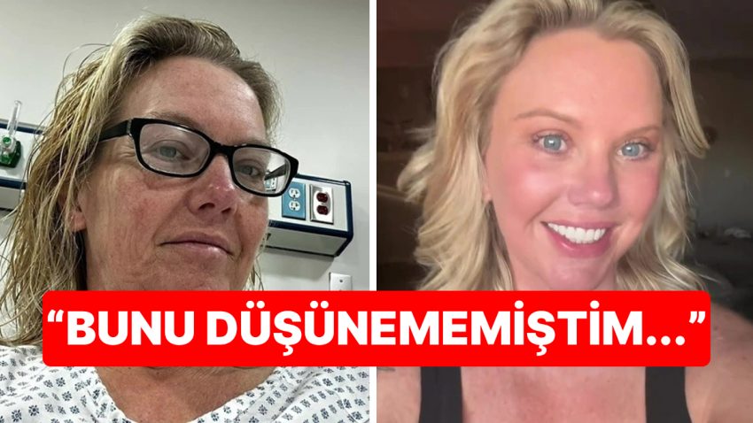 Tam Tamına 38 Kilo Verdi, Beklenmedik Yan Tesir Yüzünden Estetik Operasyona Mahkum Oldu