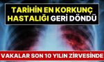 tarihin-en-vahim-hastaligi-geri-dondu-covidden-daha-olumcul-olabilir-jiYDRhRz.jpg