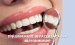 teknikleri-nedir-nasil-yapilir-tum-taraflariyla-dis-beyazlatma-EqrHGmie.jpg