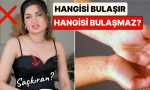 uzman-dermatolog-cilt-hastaliklarinin-hangilerinin-bulasici-hangilerinin-olmadigini-anlatti-67ac9k15.jpg