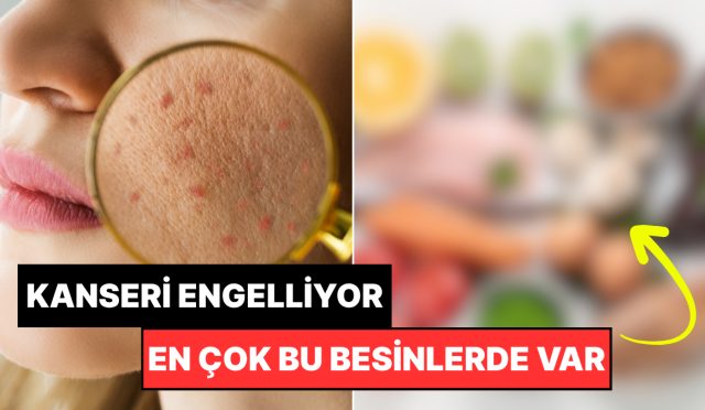 uzmanlar-acikladi-cilt-kanseri-riskini-yari-yariya-azaltan-o-vitamin-ylG6OOiQ.jpg