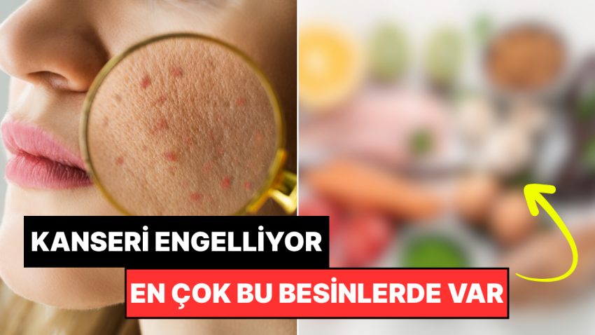 Uzmanlar Açıkladı: Cilt Kanseri Riskini Yarı Yarıya Azaltan O Vitamin