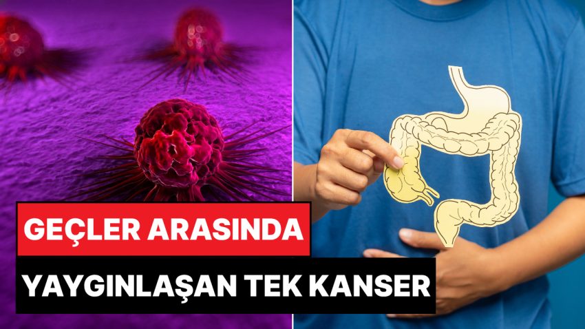 Uzmanlar Uyardı: Gençler Ortasında Bu Kanser Tipi Yaygınlaşmaya Başladı
