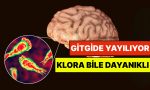 uzmanlardan-korkutan-beyin-yiyen-amip-uyarisi-dunya-genelinde-su-sistemlerine-yayiliyor-BY9xqHZM.jpg