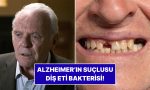 uzmanlardan-sasirtan-arastirma-alzheimerin-kaynagi-dis-eti-bakterisi-olabilir-WrODmpGe.jpg