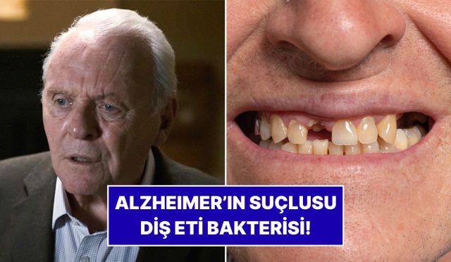 uzmanlardan-sasirtan-arastirma-alzheimerin-kaynagi-dis-eti-bakterisi-olabilir-WrODmpGe.jpg