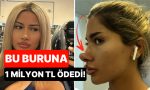 yaklasik-1-milyon-tl-odedi-burun-estetigi-yuzunden-michael-jacksona-benzetilen-bayan-isyan-etti-CtDGmzBD.jpg