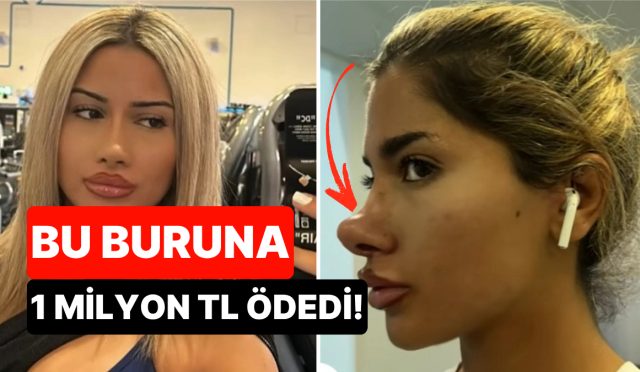 yaklasik-1-milyon-tl-odedi-burun-estetigi-yuzunden-michael-jacksona-benzetilen-bayan-isyan-etti-CtDGmzBD.jpg