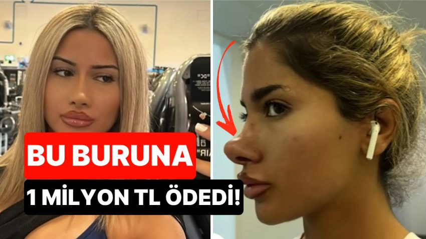 Yaklaşık 1 Milyon TL Ödedi: Burun Estetiği Yüzünden Michael Jackson’a Benzetilen Bayan İsyan Etti