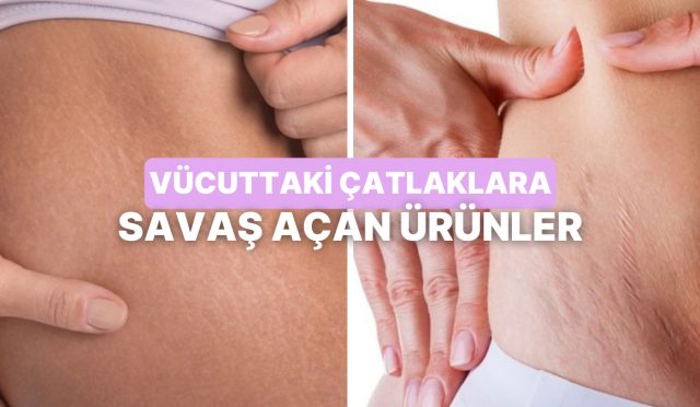 yuksek-nemlendirme-gucuyle-catlak-aykirisi-bakim-sunan-eserler-Oq6RVXqG.jpg
