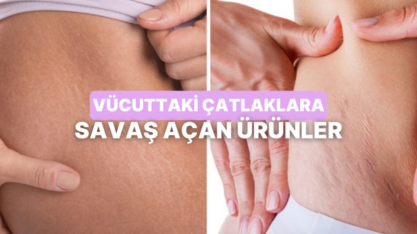 Yüksek Nemlendirme Gücüyle Çatlak Aykırısı Bakım Sunan Eserler