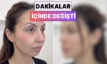 yuzunun-bes-farkli-bolgesine-dolgu-yaptiran-bayanin-degisimi-viral-oldu-dWv32w7e.jpg
